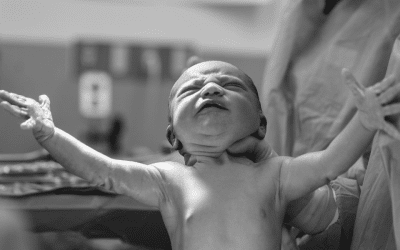 EFT for Birth with Cord Around the Neck